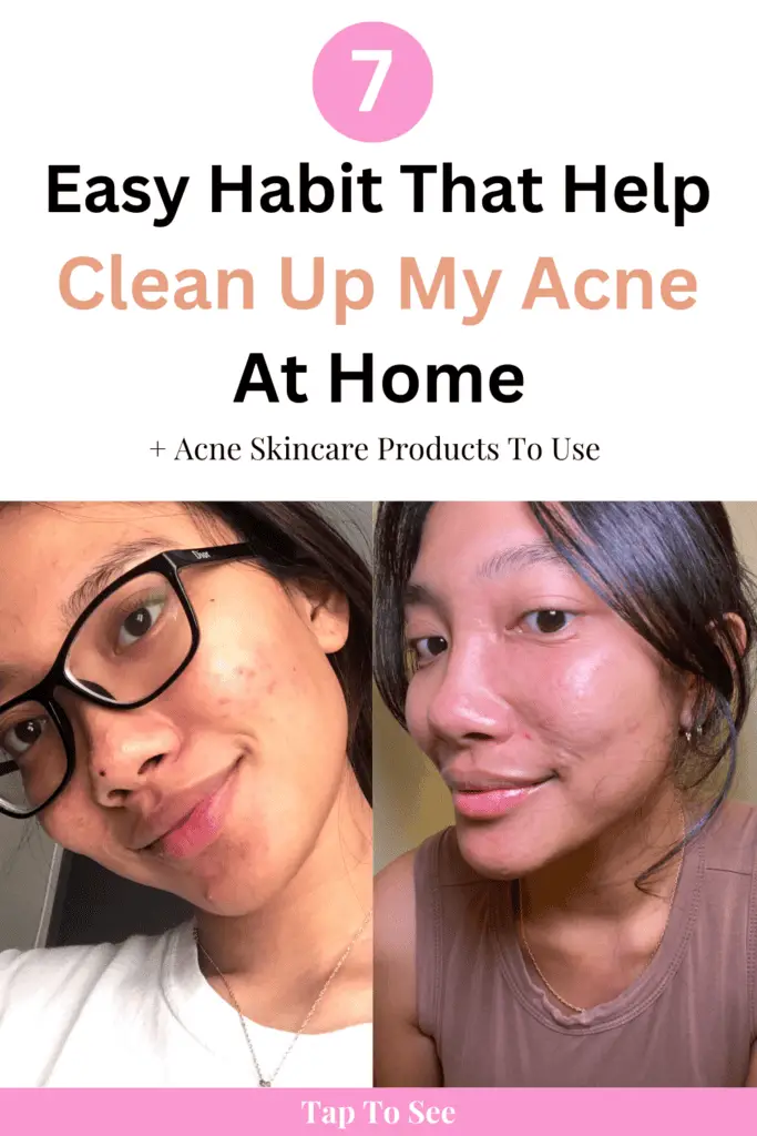 7 easy habit to follow to get clean face from acne at home