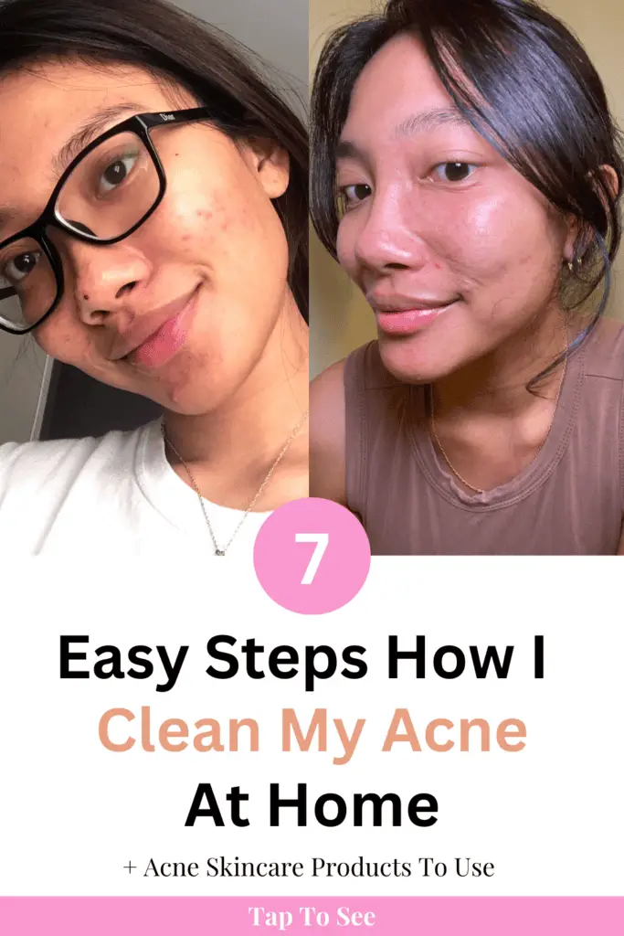 how to clean my acne with easy acne skincare routine