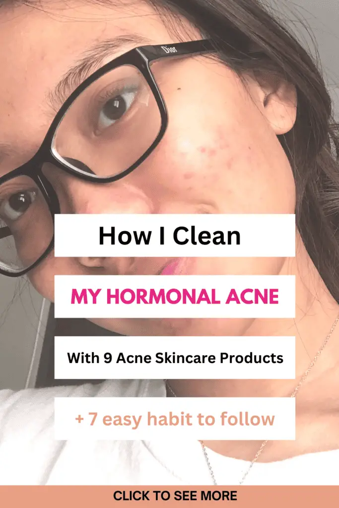 how i clean my hormonal acne with 9 affordable acne skincare products